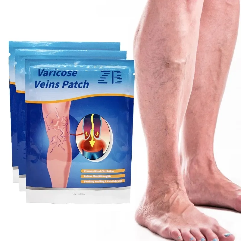 ZB Varicose Veins Patch Treatment For Varicose Veins Vasculitis Phlebitis Spider Leg Medical Patch Angiitis Removal Patch