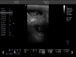 पालतू क्लिनिक के लिए पोर्टेबल पशु चिकित्सा रंग डॉपलर अल्ट्रासाउंड उपकरण - Product Image 4