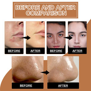 มาสครับขัดผิวหน้าและขัดผิวด้วย<span class=keywords><strong>โฟม</strong></span>สูตรเข้มข้นเพื่อผิวเรียบเนียนและทำให้ผิวกระจ่างใส - Product Image 5