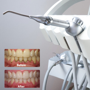 Machine de polissage <span class=keywords><strong>dentaire</strong></span> électrique, turbine, équipement de nettoyage et de remplissage, minimise les dommages, métal HengHu - Product Image 4