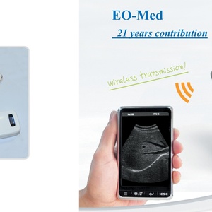 Sonde échographique convexe sans fil à prix direct usine, sonde portative courbe Wi-Fi ultra économique pour vétérinaire BW11 - Product Image 2