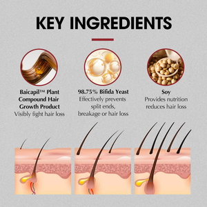 <span class=keywords><strong>Shampooing</strong></span> pour femmes marque privée produits <span class=keywords><strong>de</strong></span> soins capillaires biologiques épaississement repousse anti-<span class=keywords><strong>chute</strong></span> - Product Image 3