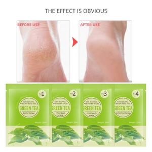 Vendedor caliente 4 en I Kit de pedicura <span class=keywords><strong>para</strong></span> el cuidado de los pies Producto de spa Etiqueta privada Kit de spa de lujo Pie Soak Pedi Cure Foot Mask - Product Image 2