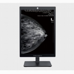 Écran médical haute résolution pour mammographie, visualiseur de radiographie, moniteur médical pour usage humain et vétérinaire - Product Image 5