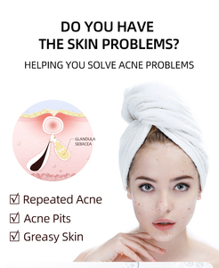 Gel Rapido Anti-Acne con Acido Salicilico e Tè Verde per Pelli a Tendenza Acneica, Prodotto dal Produttore - Product Image 5