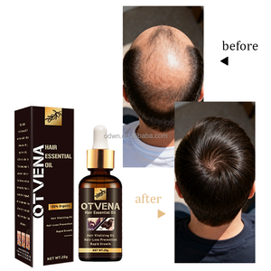 Huile de croissance capillaire OTVENA en marque blanche : favorise la pousse de la barbe et <span class=keywords><strong>des</strong></span> <span class=keywords><strong>sourcils</strong></span>, nourrit les pointes sèches et abîmées - Product Image 4