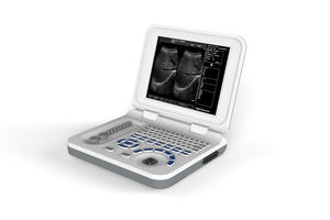 Scanner portatif d'ultrason avec l'imagerie à haute résolution, conception légère pour le diagnostic médical - Product Image 2