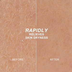 Loción Corporal Hidratante con Aroma Fresco a Aceite de Almendras, Suave, No Irritante, Alivia la Piel y Desodoriza - Product Image 4