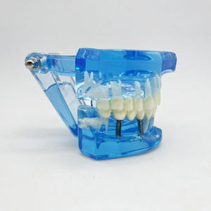 Modèle de réparation bleu école de médecine restauration des nerfs dentaires modèle humain modèle dentaire médical - Product Image 4