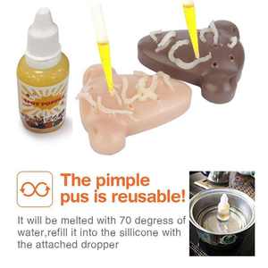 Pimple Popper Toys Nariz Recargable Squeeze Acné Pimple Popping Alivio del estrés Popper Remover Stop Fun Toy - Product Image 5