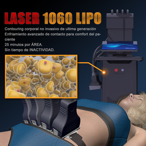 Diodo Laser corpo dimagrante stazionario 4-Handle sistema di raffreddamento per efficace perdita di peso e rimozione di grasso 1060nm - Product Image 2