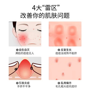 Acne Needle Set Stainless Steel Four Piece For Face Blackhead <b>Remover</b> Tool - Product Image 3
