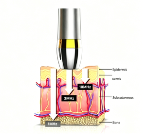 Portable Ultrasonic Facial Device <strong>3MHz</strong> 10MHz Skin Tightening Beauty Machine ODM Factory Anti Aging Lifting Skin Care Device - Product Image 2