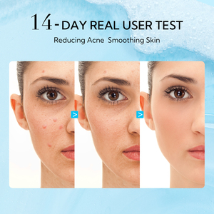 Lanbena Hot Sales BHA Smoothing <strong>Cleanser</strong> Body Wash Whitening <strong>Hyaluronic</strong> Acid Facial Face <strong>Cleanser</strong> - Product Image 6