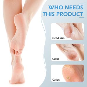 Kit de pédicure 4 en 1 : Pierre ponce, brosse exfoliante pour les pieds, éliminateur de callosités, limes à pieds en plastique pour éliminer les peaux mortes - Product Image 4
