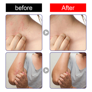 Spedizione gratuita sentymed vendita calda <span class=keywords><strong>crema</strong></span> <span class=keywords><strong>antibatterica</strong></span> delicata per la pelle <span class=keywords><strong>e</strong></span> facile da trasportare per una vita migliore - Product Image 3