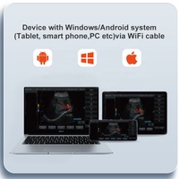 Échographe vétérinaire portable Yonker Wifi Mini à double sonde pour animaux de compagnie et animaux, scanner à ultrasons pour vétérinaires