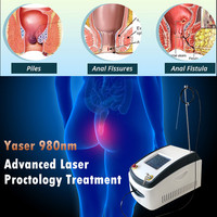 Bonne qualité 980nm meilleurs traitements des hémorroïdes fistule fissure Pilonidal Sinus dispositif