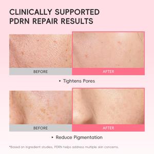 LAIKOU PDRN Centella Ampoule Serumディープハイドレーションは乾燥度を向上させますファインラインは明るく強化された肌のエッセンスを減らします - Product Image 3