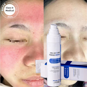 Sérum réparateur pour le visage après traitement, la couleur rouge disparaîtra en 3 minutes, soin pour peaux sensibles, collagène, spray stérile pour le visage - Product Image 1
