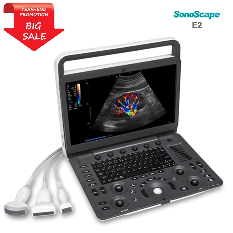 Medsinglong instrumen Ultrasound medis MSK OB/GYN 3D 4D 5D pemindai Ultrasound sonosbape E2 mesin Ultrasound portabel