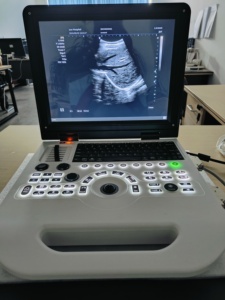 3d 4d Máquina Mais Barato Venda Quente Portátil Cor <span class=keywords><strong>Doppler</strong></span> Ultrassom Máquina Humano Vet - Product Image 2