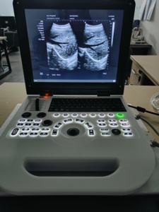 Mesin <span class=keywords><strong>Ultrasound</strong></span> portabel dokter hewan medis 4d 3d termurah untuk harga warna sapi terapi kucing anjing pilihan dengan pemindai warna - Product Image 2