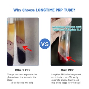 Tubos 10ML PRP Tubo ACD y Gel + Anticoagulante para Plasma Rico en Plaquetas - Product Image 3