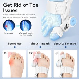 <span class=keywords><strong>Correcteur</strong></span> d'<span class=keywords><strong>hallux</strong></span> <span class=keywords><strong>valgus</strong></span> pour femmes et hommes, redresseur d'orteil, attelle orthopédique en silicone réglable avec bouton, séparateur d'orteils, soulagement de la douleur - Product Image 2