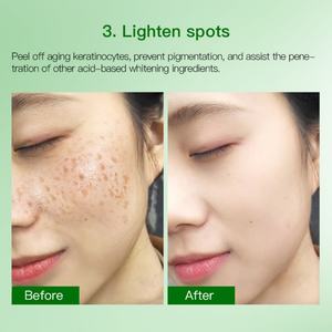 Mascarillas Faciales Hidratantes Antienvejecimiento para el Cuidado de la Piel, Calmantes para el Acné, con Ácido Salicílico, Control de Grasa, en Tabletas de Algodón - Product Image 5