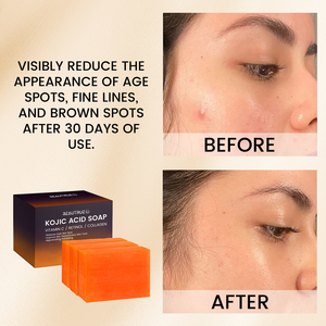 Savon Acide Kojique Original Éclaircissant Peau Nettoyant Visage Barre Blanchissante Hydratante Éclat Naturel Fournisseur - Product Image 4