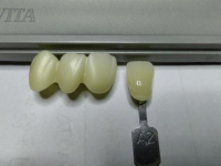 WinenDent Meilleur Prix 98 95 Zirkonzahn AG Amman Girrbach 4D Plus ML 10mm Taille Zirconium Porcelaine Bloc de Céramique de Zircone vierge