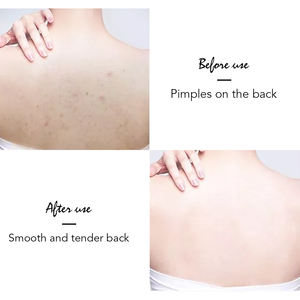 <span class=keywords><strong>Gel</strong></span> <span class=keywords><strong>Douche</strong></span> Exfoliant pour le Corps à la Niacinamide Naturelle et à l'Avocat pour Femmes avec Effets Éclatants, Nettoyants en Profondeur et Blanchissants - Product Image 6