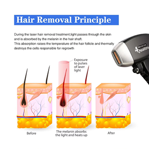 Appareil de rajeunissement cutané de bureau portable 755nm 808nm 1064nm, épilation pour le visage, les mains, les pieds, élimination des tatouages au picoseconde - Product Image 6