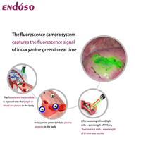 CE Approved 4K Medical Optical Rigid Endoscope Fluorescence Laparoscope for Laparoscopy Arthroscopy Hysteroscopy ENT Surgery