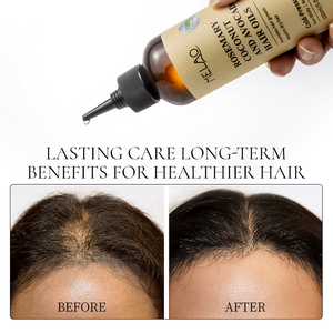 Productos Capilares, Aceite de Coco, Romero y Aguacate, Tratamiento Anticaída del Cabello, Fortalece las Raíces, Efecto Engrosador, Aceite para el Crecimiento del Cabello - Product Image 3