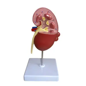 Модель почечной кисты, медицинская обучающая модель анатомии человека, оборудование для почечной патологии, моделанатомия органов человеческого тела