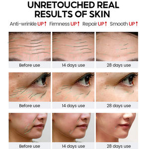 Private Label OEM/ODM Brightening Retinol AHA Hyaluronic <b>Acid</b> Herbal Moisturizing Whitening Facial Skin Care Set - Product Image 3