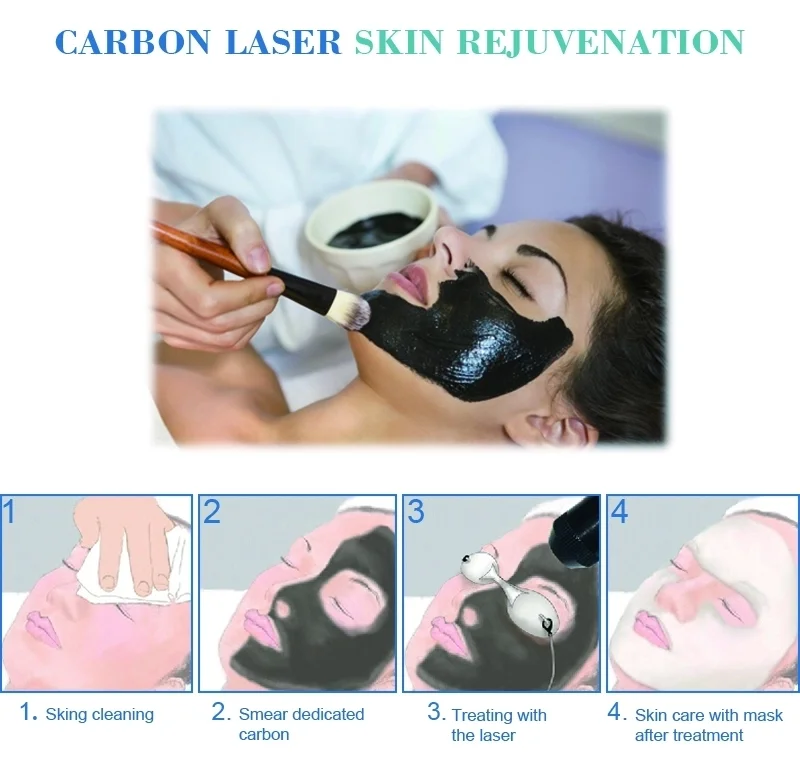 Diodo de la certificación 808 del CE lasers del yag del laser + del nd para la peladura del laser del carbono de la reducción de los puntos del retiro del tatuaje