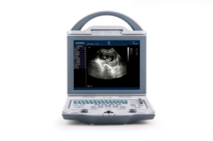 Ecógrafo Veterinario Digital KAIXIN KX5600V con Sonda Convexa Lineal para Perros, Gatos y Animales Pequeños - Product Image 4
