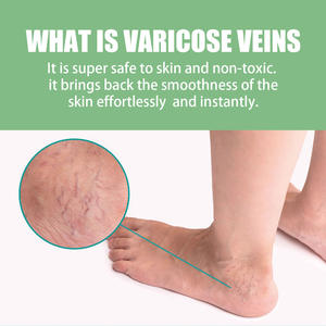 50g Factory Direct Sale <strong>Best</strong>-selling <strong>Varicose</strong> <strong>Vein</strong> Repair <strong>Cream</strong> - Product Image 6