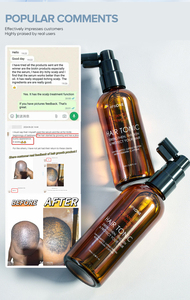İncelen Saçlar İçin Saç Uzatma Serumu - Kafein ve Biotin İçeren Saç Derisi Bakımı, Hızlı Emilen ve Saç Yoğunluğunu Artırıcı 100ml - Product Image 3