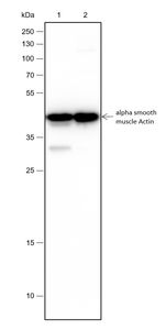 Anticuerpo Monoclonal de Actina Muscular Lisa Alfa Recombinante - Product Image 2