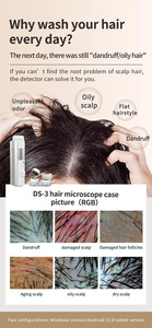 Portable Advanced Hair Loss Analyzer with Scalp Care Function for Home and Salon Skin Diagnosis Lenses Detailed Scalp Analysis - Product Image 4