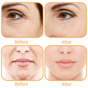 <span class=keywords><strong>Crema</strong></span> Viso Antietà Private Label Idratante Naturale per la Cura della Pelle con <span class=keywords><strong>Vitamina</strong></span> <span class=keywords><strong>A</strong></span> e Retinolo Rassodante <span class=keywords><strong>a</strong></span> <span class=keywords><strong>Base</strong></span> <span class=keywords><strong>di</strong></span> Collagene - Product Image 5