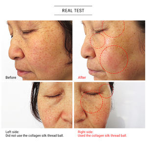 מותג פרטי קוריאני אורגני אנטי-הזדקנות קולגן משי חלבון כדור הרמת פנים סרום - Product Image 4