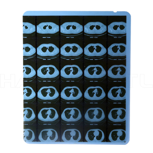 Prezzo-automatico medicale-blu-<span class=keywords><strong>x</strong></span>-<span class=keywords><strong>ray</strong></span>-<span class=keywords><strong>film</strong></span>-processore <span class=keywords><strong>Fuji</strong></span>-giappone-produttore - Product Image 6