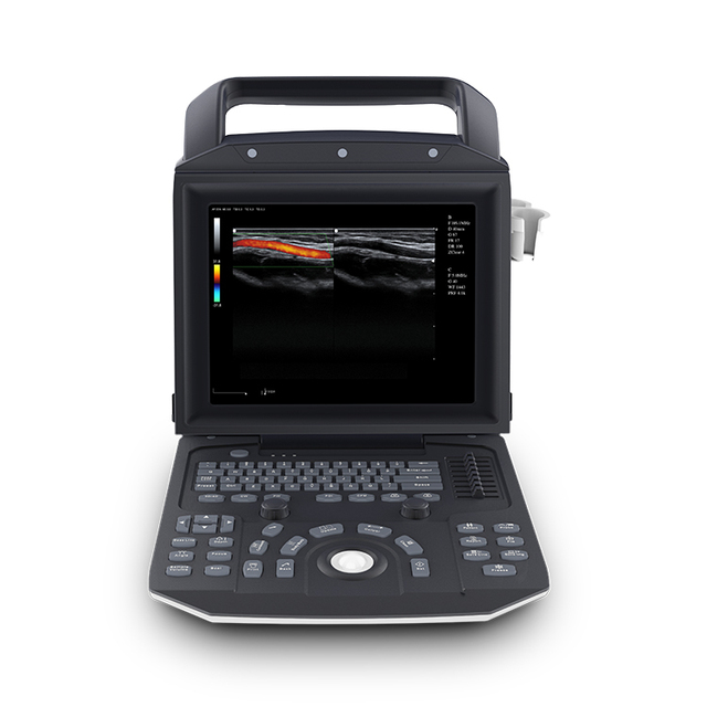 Laptop Color Doppler Portable Ultrasound Scanner Machine for Human Medical Equipment Zoncare I50