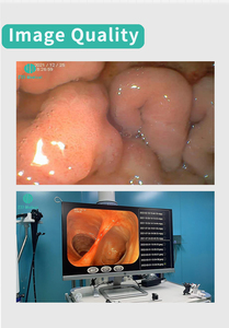 Endoscopio Digital de Alta Resolución para Hospitales, Gastroscopia Electrónica y <span class=keywords><strong>Enteroscopia</strong></span> Electrónica para el Tracto Digestivo Superior - Product Image 6