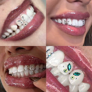 Kit de décoration professionnel avec lampe de durcissement LED, colle à résine, pierres précieuses pour les dents et <span class=keywords><strong>strass</strong></span> pour une utilisation polyvalente en matière de beauté - Product Image 2